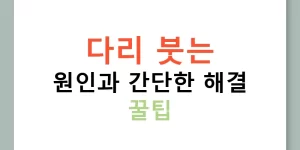 다리 붓는 원인과 간단한 해결 꿀팁